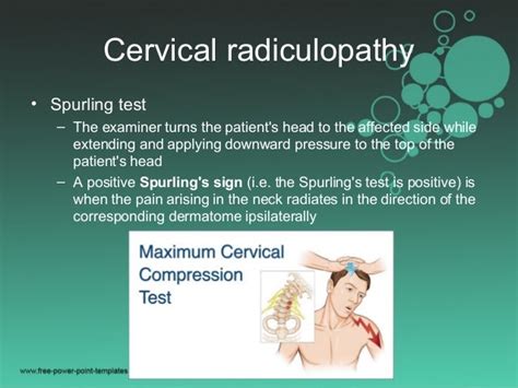 278 Treatment of disk and ligamentous diseases of the cervical spine