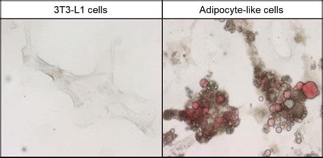 Differentiation of 3T3-L1 cells into adipocyte-like cells: case study : Abcam protocols