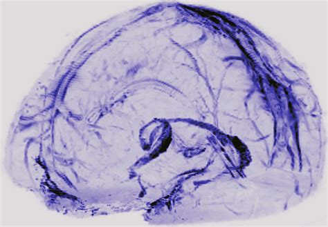 NIH researchers uncover drain pipes in our brains | National Institutes of Health (NIH)