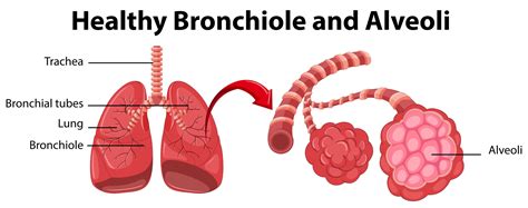 Diagram showing healthy bronchiole and alveoli 434375 Vector Art at ...