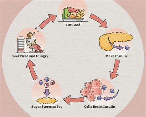 Insulin resistance diet and its health benefits - Sugar Zam