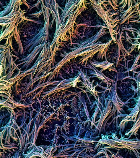 How This Lung-On-A-Chip Could Help Asthma Patients Breathe Easier