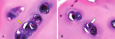 The cartilage lacunae are actually artificial gaps, formed by ...