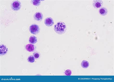 Chromosomes Human Under the Microscope. Stock Photo - Image of ...