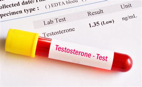 At Home Hormone Test Kit | Protein Factory