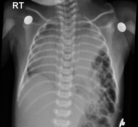 Pin on Paediatric Radiology