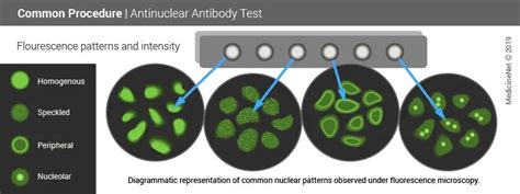 Antinuclear Antibody Test Normal Range & Interpretation