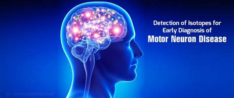 Motor Neuron Disease - Using Isotope Gives New Hope for Early Diagnosis | Huntington disease ...