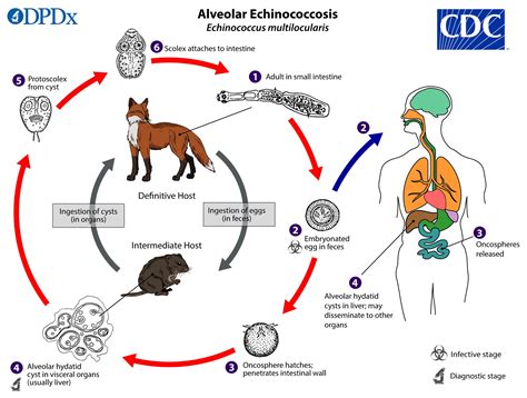 Echinococcus/Echinococcosis | Concise Medical Knowledge