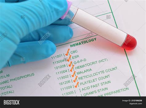 Hematology Tests and Procedure - Imad Analis Blog