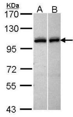 Kell Antibody (NBP1-33660): Novus Biologicals