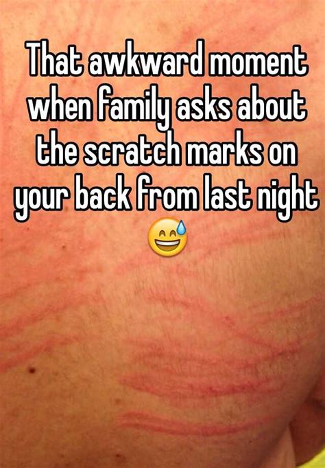 That awkward moment when family asks about the scratch marks on your ...