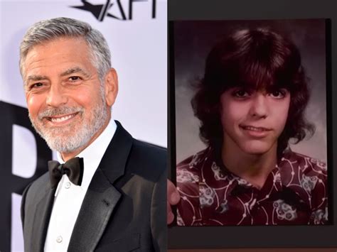 George Clooney reveals he had Bell’s palsy as a teenager