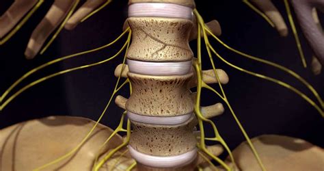 Herniated Disc S1 - S2 Symptoms & Treatment - Dr. Kevin Pauza, The ...