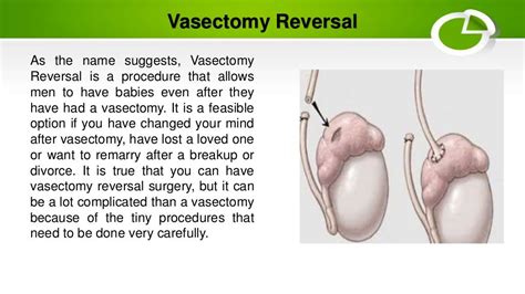 Vasectomy Procedure