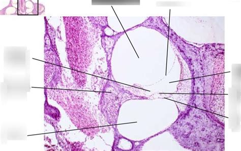 Exercise 25 - Cochlea Cross Section Histology Slide Diagram | Quizlet