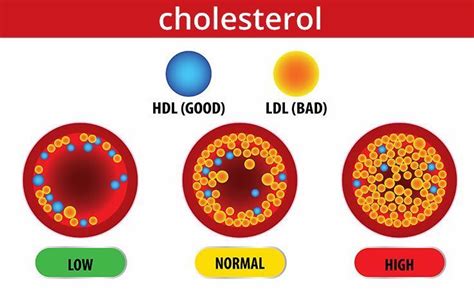 Apa Beda Kolesterol dan Trigliserida? - seputargk.id