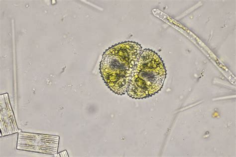 Cosmarium reniforme | The Microscopic Life of Shetland Lochs