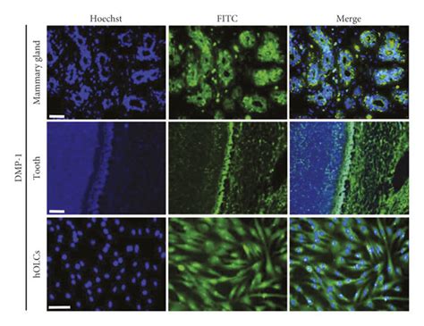 Immunocytochemical detection of odontogenic markers DMP-1 and DSP in... | Download Scientific ...