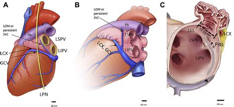 Left Atrial Appendage: Embryology, Anatomy, Physiology, Arrhythmia and Therapeutic Intervention ...