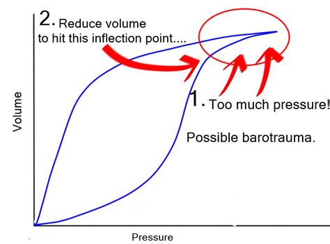 Mechanical Ventilation Series- Pressure/Volume loop….. - Critical Care Practitioner