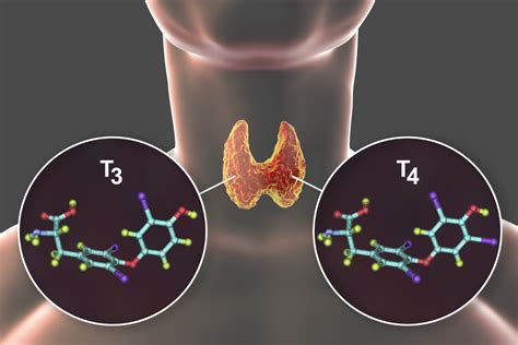 How Thyroid Hormone Therapy Can Reduce Hypothyroidism - Natural Bio Health