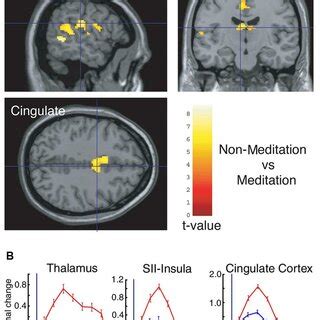 A) Significant differences were observed between non-meditation and ...