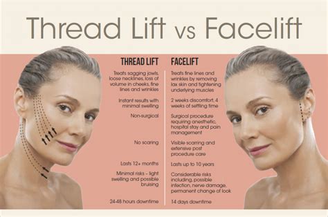 Facelift or Thread Lift?