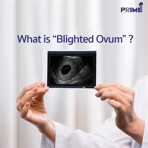 What is “Blighted Ovum”? | Infertility Treatment - Prime Fertility Clinic