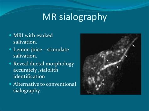 Salivary gland imaging