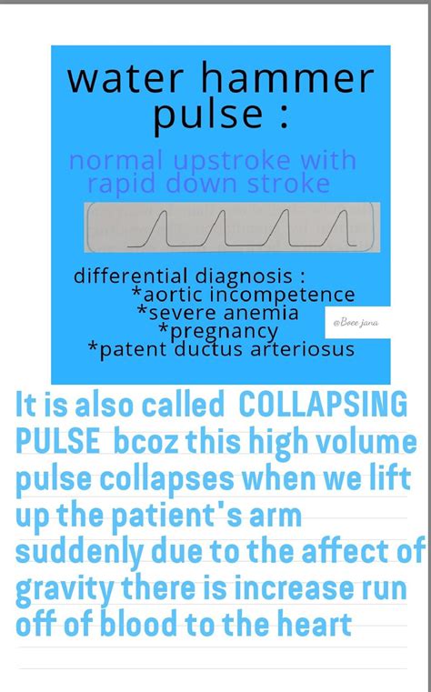 Collapsing pulse in 2021 | Nursing school survival, Cardiology, School survival