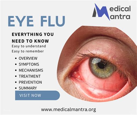 Eye Flu: Causes, Symptoms, Treatment, Prevention, and Medical Mechanism ...