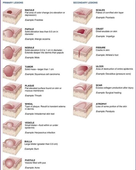 Pin on Medical