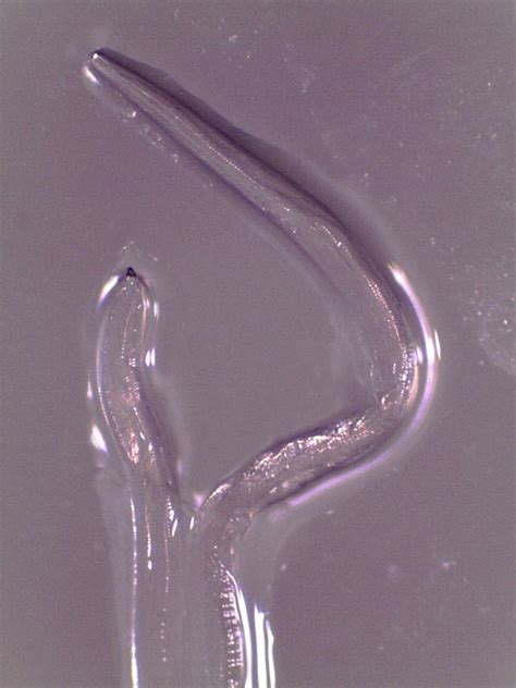 Hookworm In Human Eye