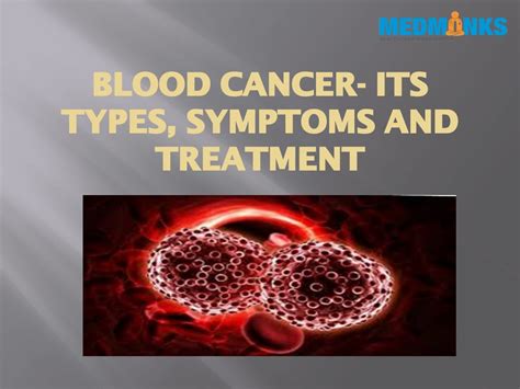 PPT - BLOOD CANCER- ITS TYPES, SYMPTOMS AND TREATMENT | Medmonks PowerPoint Presentation - ID ...