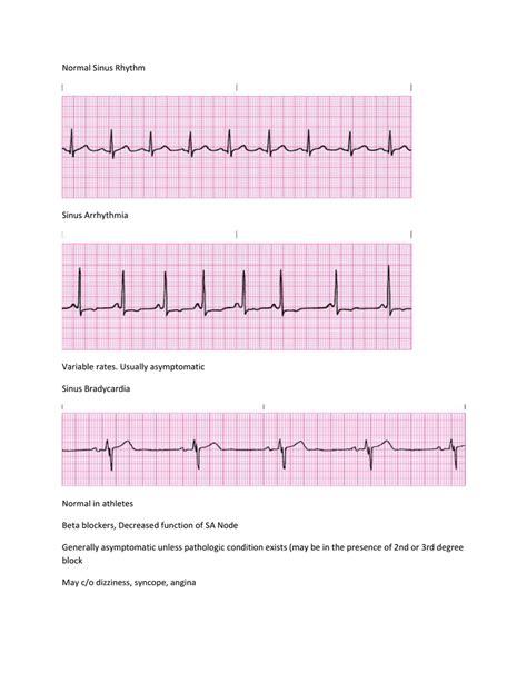 Abnormal EKG study guide comp
