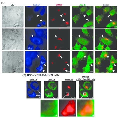 Detection of extracellular ER lumen proteins in the secreted medium... | Download Scientific Diagram