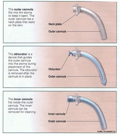 25 Tracheostomy ideas | tracheostomy, respiratory therapy, medical knowledge