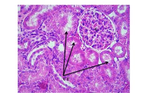 Histological section of hepatic tissue of Liver control group shows... | Download Scientific Diagram