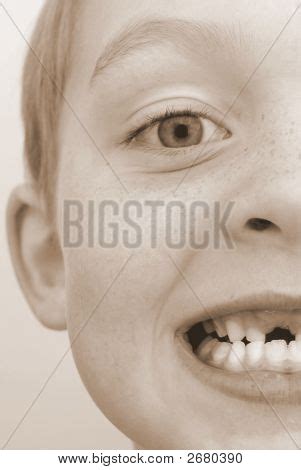 Missing Tooth Image & Photo (Free Trial) | Bigstock