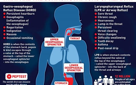 What is Gastro-oesophageal reflux disease? Peptest blog