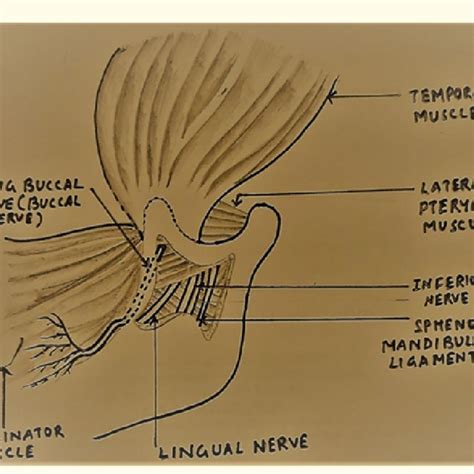 (PDF) EC DENTAL SCIENCE Case Report Neurolysis of Buccal Nerve ...