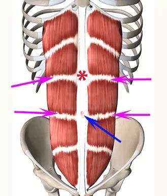 Lesson-Rectus-sheath – USabcd