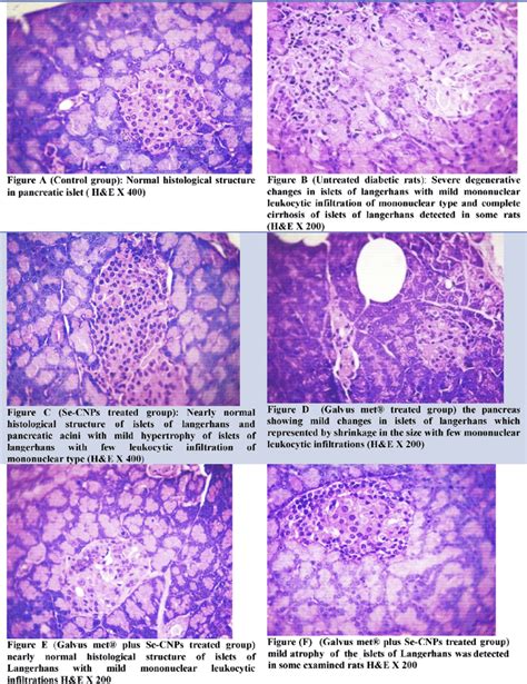 (A) Control group: Normal histological structure in pancreatic islet ...