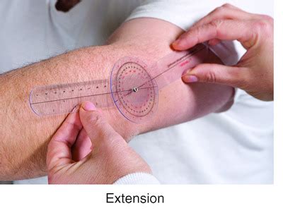 goniometer | Taber's Medical Dictionary