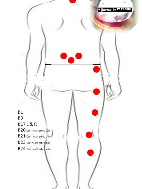 58 HIJAMA POINTS ideas in 2021 | hijama, hijama points, cupping therapy