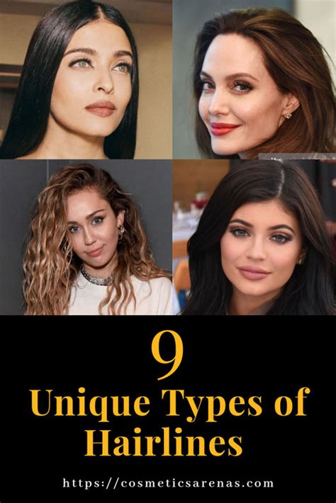 9 Types of Hairlines You Never Knew Existed! - Cosmetics Arena