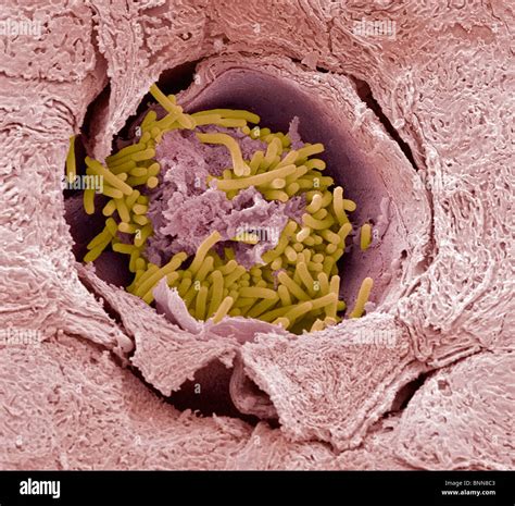 Tongue bacteria, SEM Stock Photo - Alamy