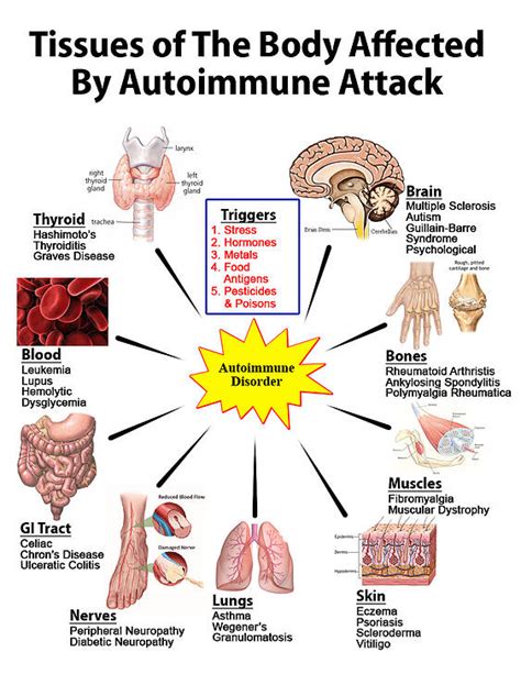 Top 11 Best Anti-Inflammatory Foods To Thwart Autoimmunity