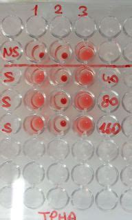 Agglutination | Definition, Reaction & Examples - Lesson | Study.com